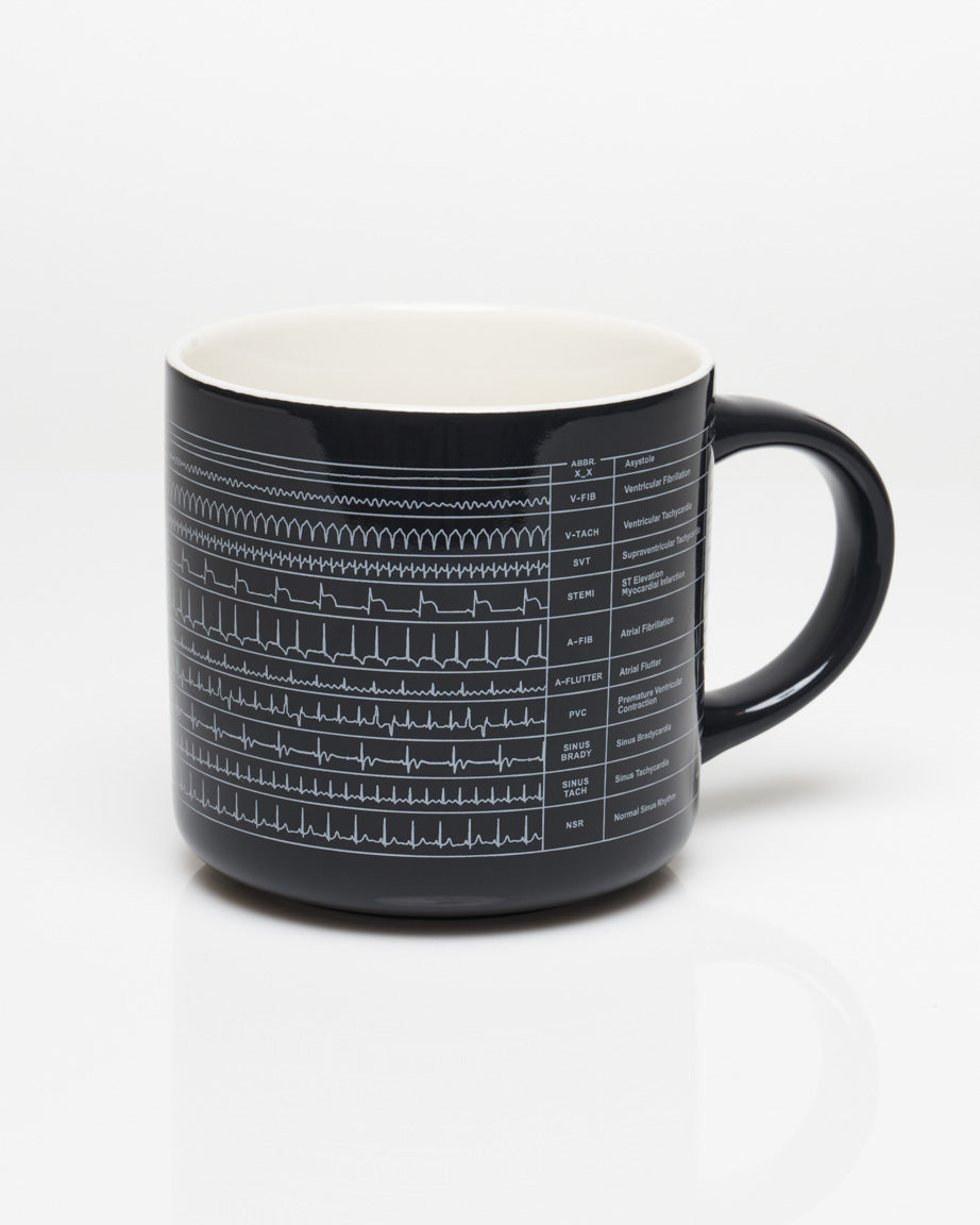 Heartbeat 15 oz Ceramic Mug