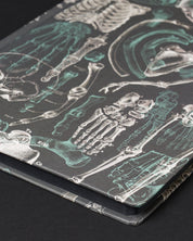 Skeleton Dark Matter Notebook