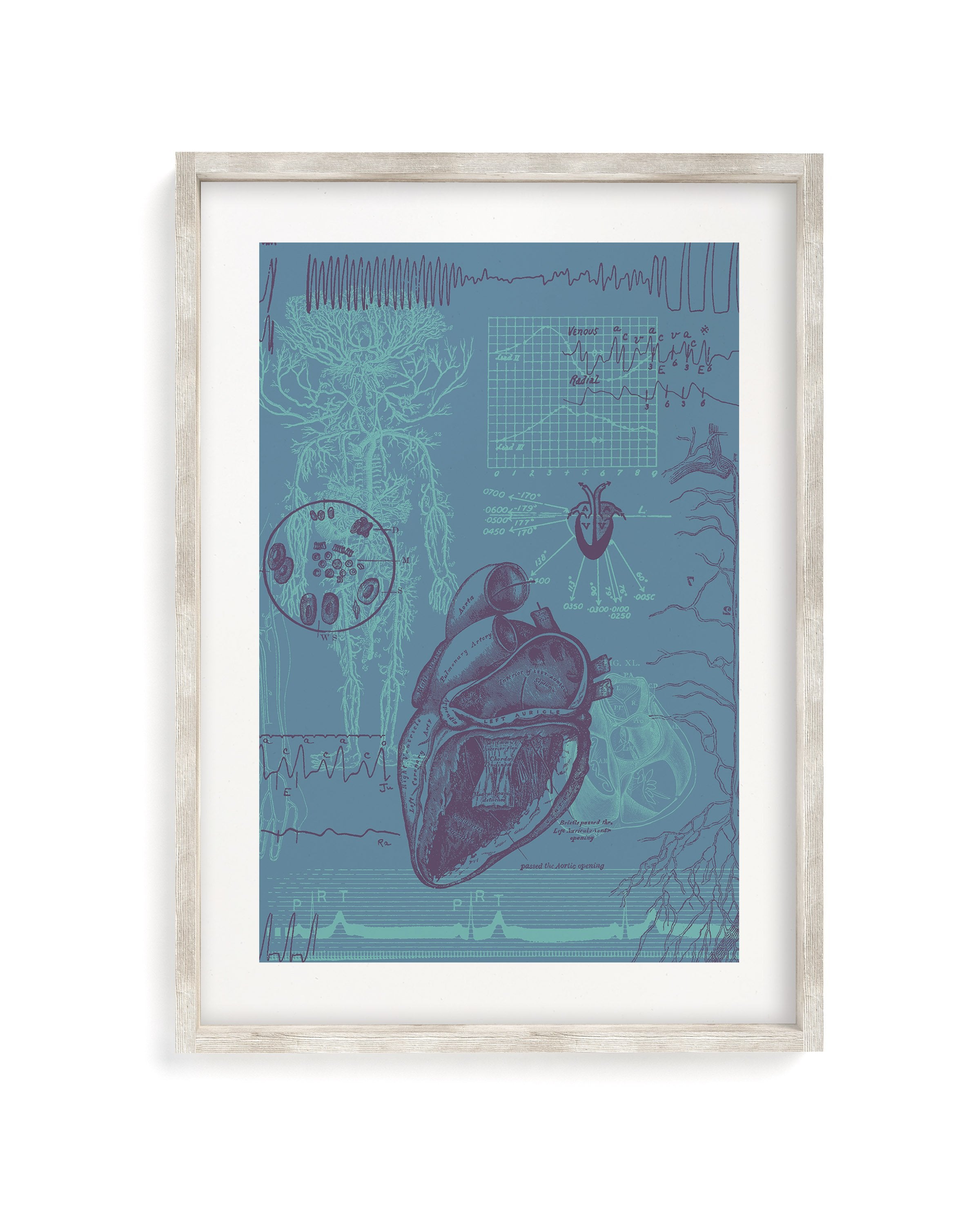 Cardiology Museum Print