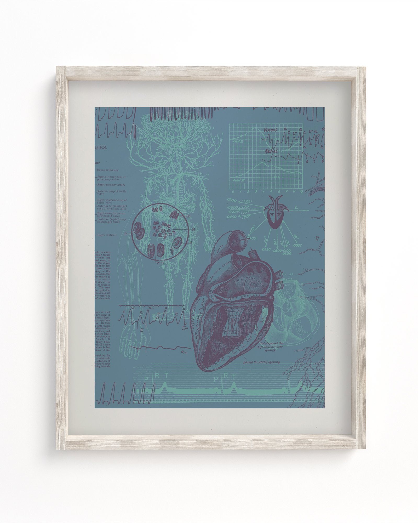 Cardiology Museum Print